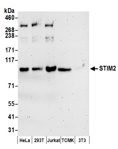 STIM2 Antibody in Western Blot (WB)