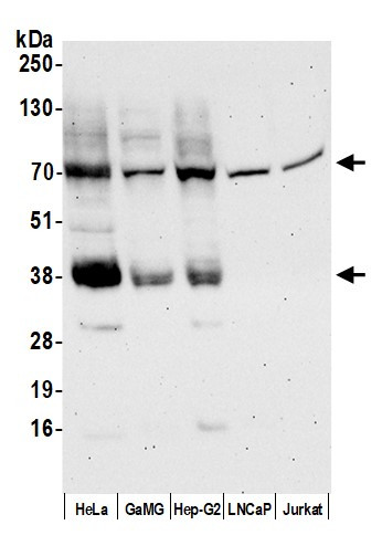 MCT4 Antibody in Western Blot (WB)