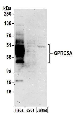 GPRC5A Antibody in Western Blot (WB)