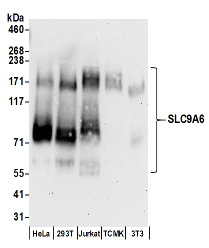 SLC9A6 Antibody in Western Blot (WB)