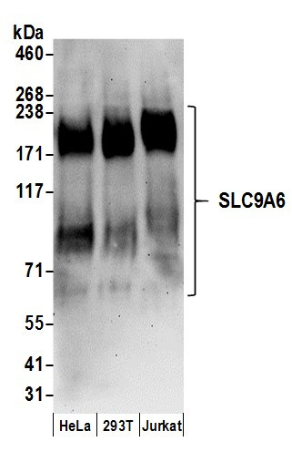 SLC9A6 Antibody in Western Blot (WB)