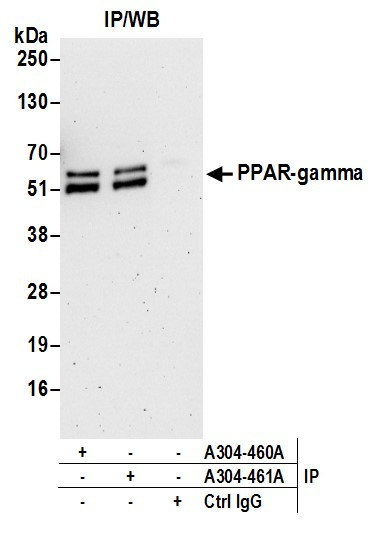 PPAR-gamma Antibody in Immunoprecipitation (IP)