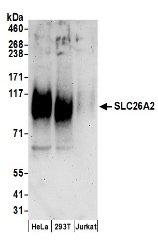 SLC26A2 Antibody in Western Blot (WB)