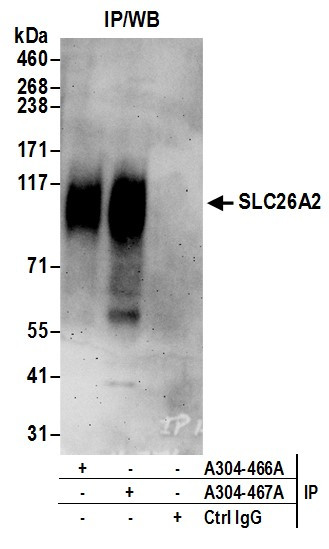 SLC26A2 Antibody in Immunoprecipitation (IP)