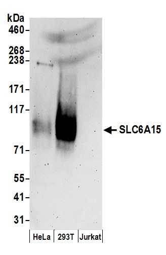 SLC6A15 Antibody in Western Blot (WB)