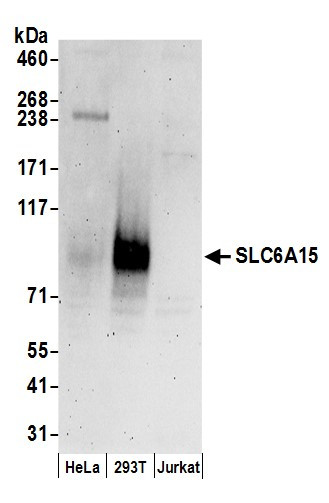 SLC6A15 Antibody in Western Blot (WB)