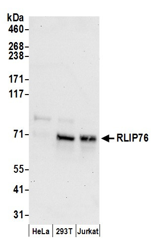 RLIP76 Antibody in Western Blot (WB)