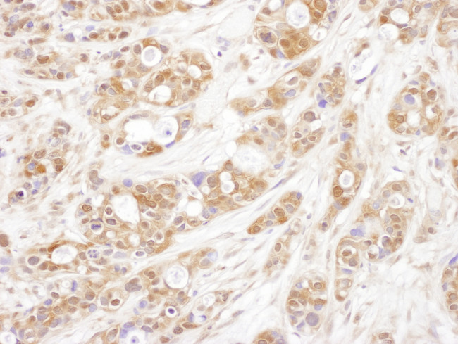 P23 Antibody in Immunohistochemistry (Paraffin) (IHC (P))