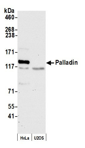 Palladin Antibody in Western Blot (WB)