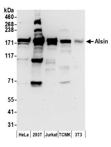 Alsin Antibody in Western Blot (WB)