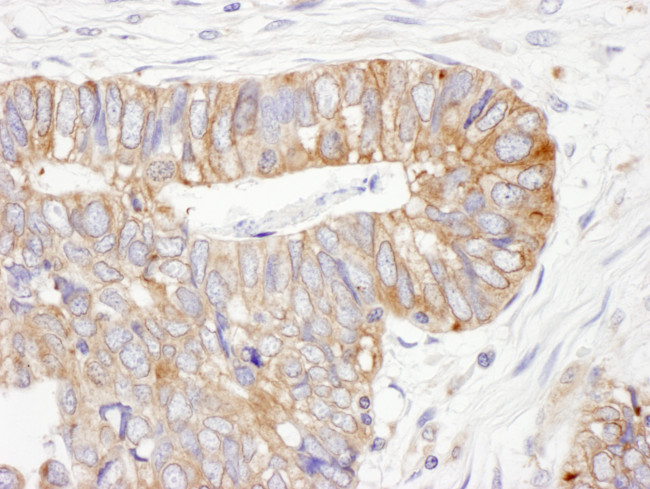 ERp5 Antibody in Immunohistochemistry (Paraffin) (IHC (P))