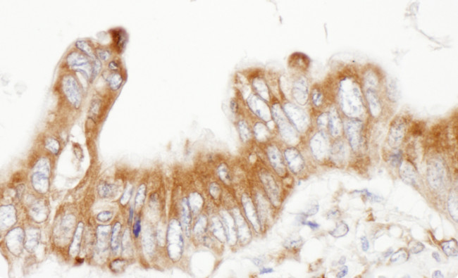 ERp5 Antibody in Immunohistochemistry (Paraffin) (IHC (P))