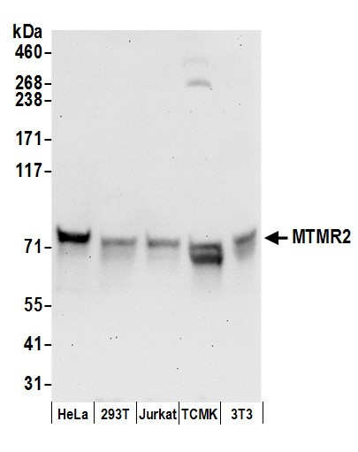 MTMR2 Antibody in Western Blot (WB)