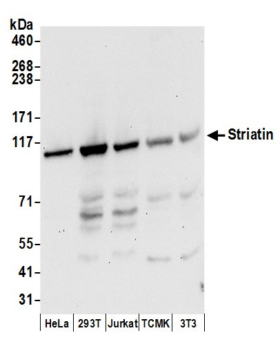 Striatin Antibody in Western Blot (WB)