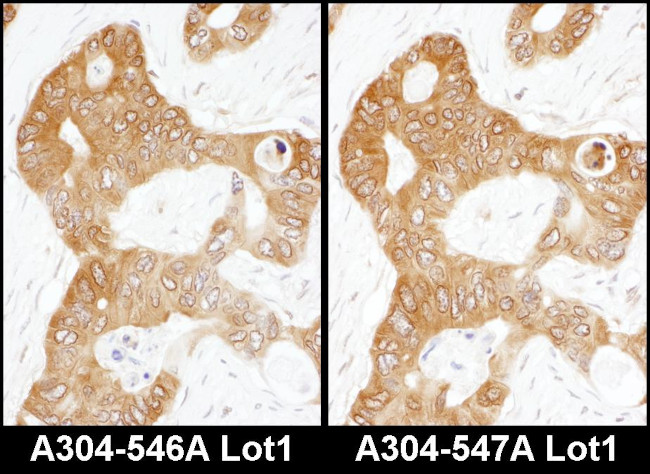 ADE2 Antibody in Immunohistochemistry (Paraffin) (IHC (P))