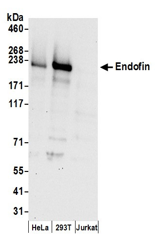 Endofin Antibody in Western Blot (WB)