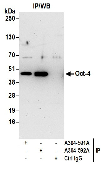 Oct-4 Antibody in Immunoprecipitation (IP)