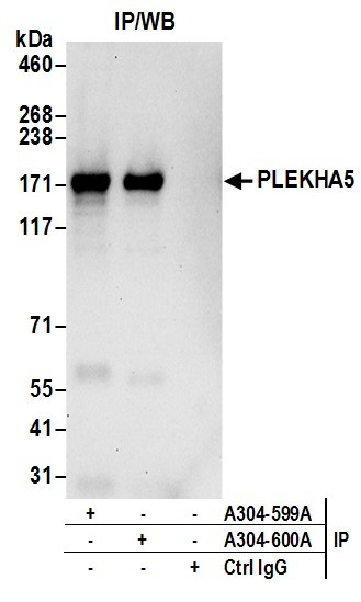 PLEKHA5 Antibody in Immunoprecipitation (IP)