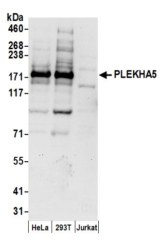 PLEKHA5 Antibody in Western Blot (WB)