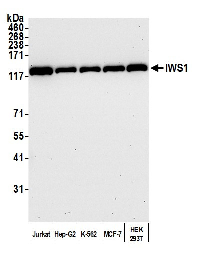 IWS1 Antibody in Western Blot (WB)