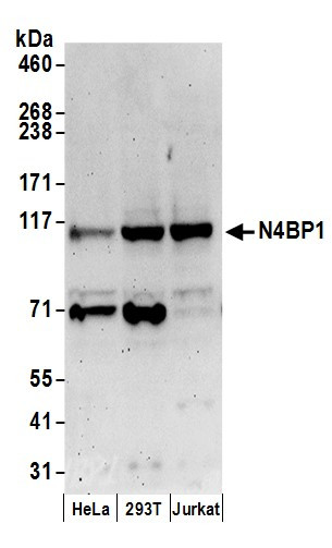 N4BP1 Antibody in Western Blot (WB)