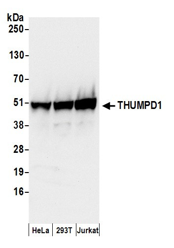 THUMPD1 Antibody in Western Blot (WB)