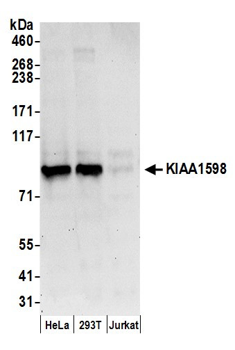 KIAA1598 Antibody in Western Blot (WB)