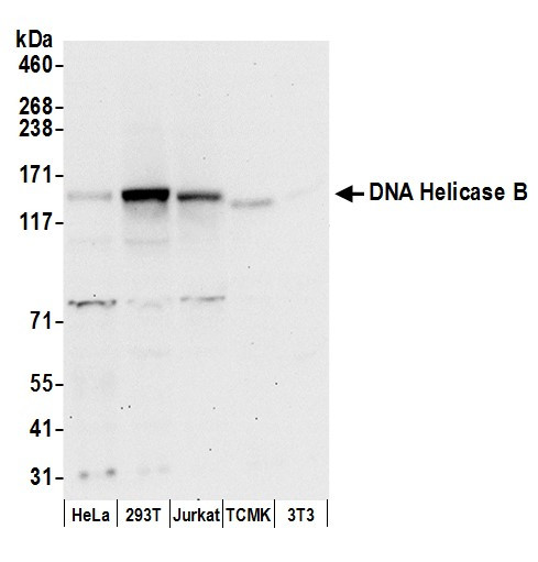 DNA Helicase B Antibody in Western Blot (WB)