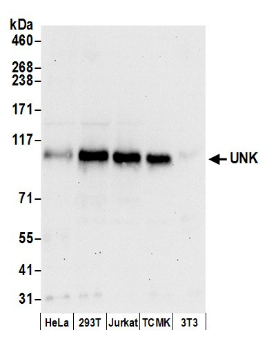 UNK Antibody in Western Blot (WB)