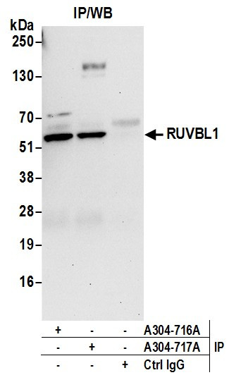 RUVBL1 Antibody in Immunoprecipitation (IP)