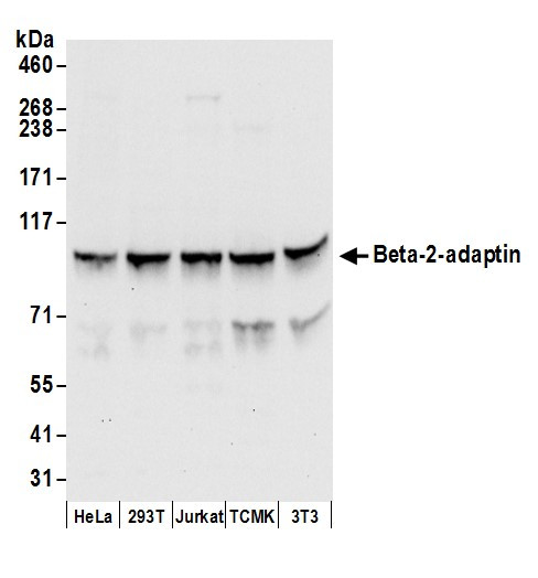 Beta-2-adaptin Antibody in Western Blot (WB)