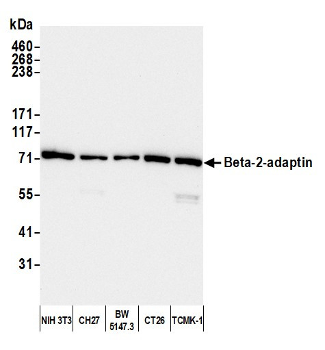 Beta-2-adaptin Antibody in Western Blot (WB)