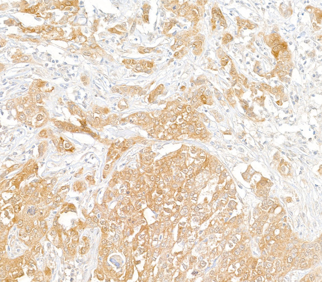 PHGDH Antibody in Immunohistochemistry (Paraffin) (IHC (P))