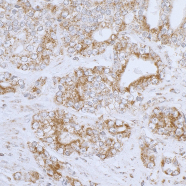 DLD Antibody in Immunohistochemistry (Paraffin) (IHC (P))