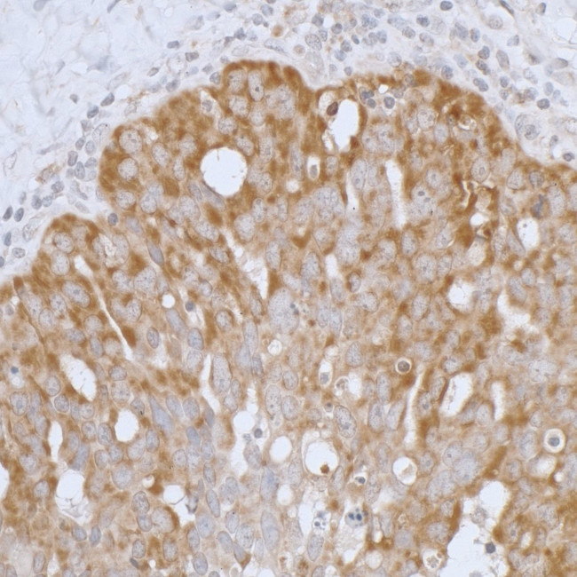 Peroxiredoxin-3 Antibody in Immunohistochemistry (Paraffin) (IHC (P))