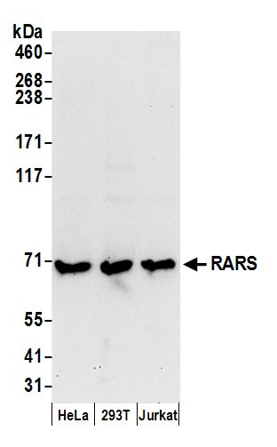 RARS Antibody in Western Blot (WB)