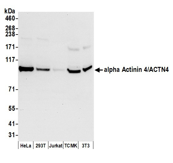 alpha Actinin 4/ACTN4 Antibody in Western Blot (WB)