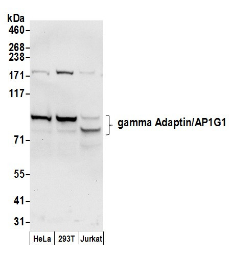 gamma Adaptin/AP1G1 Antibody in Western Blot (WB)