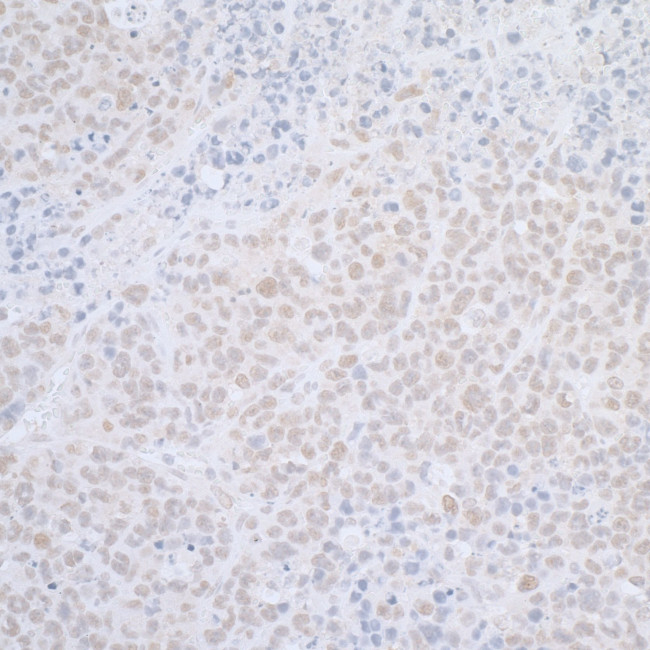 ELAC2 Antibody in Immunohistochemistry (Paraffin) (IHC (P))