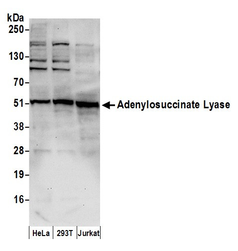 Adenylosuccinate Lyase/ADSL Antibody in Western Blot (WB)