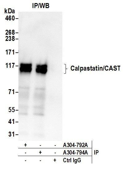 Calpastatin/CAST Antibody in Immunoprecipitation (IP)