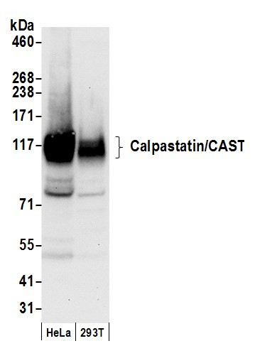 Calpastatin/CAST Antibody in Western Blot (WB)