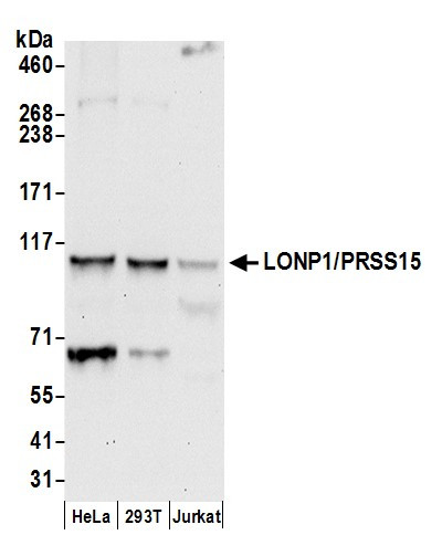 LONP1/PRSS15 Antibody in Western Blot (WB)