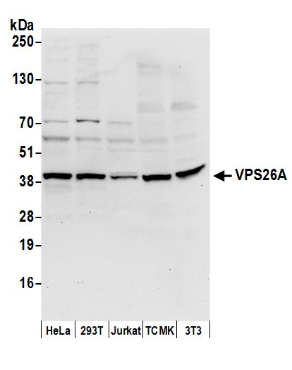 VPS26A Antibody in Western Blot (WB)