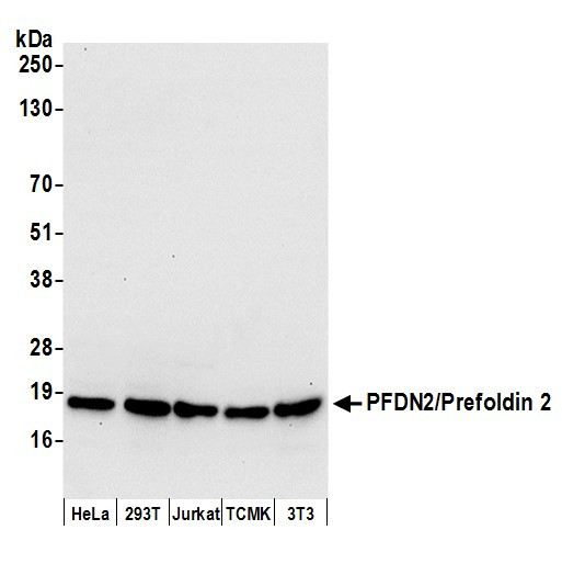 PFDN2/Prefoldin 2 Antibody in Western Blot (WB)