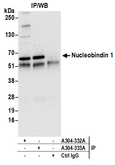 Nucleobindin 1/NUCB1 Antibody in Immunoprecipitation (IP)