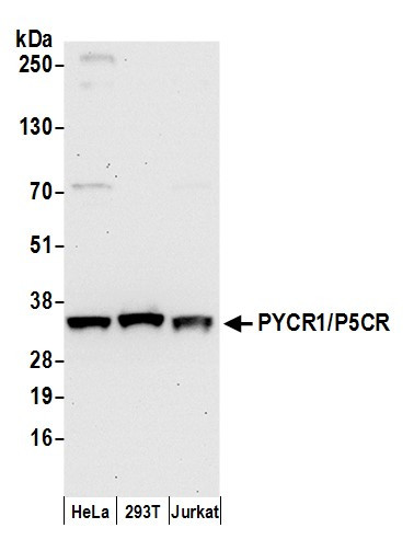 PYCR1/P5CR Antibody in Western Blot (WB)