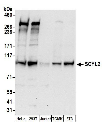 SCYL2 Antibody in Western Blot (WB)