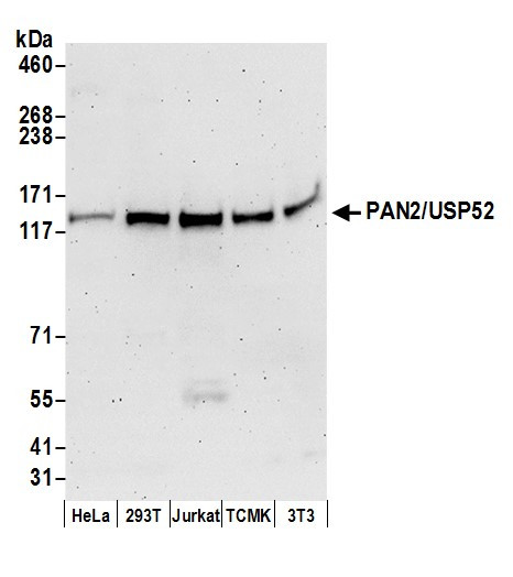 PAN2/USP52 Antibody in Western Blot (WB)