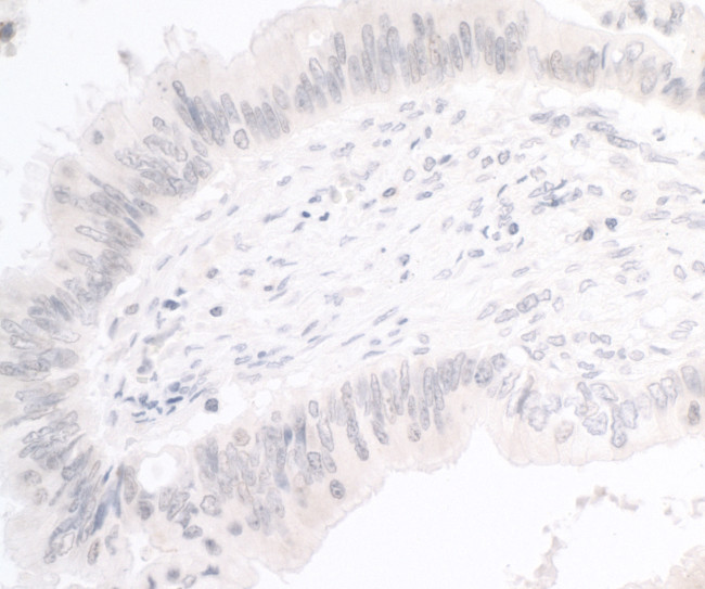 PIMT Antibody in Immunohistochemistry (Paraffin) (IHC (P))